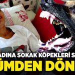 Sokak köpekleri saldıran genç kadın, ölümden döndü!