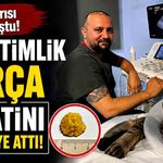 Gece Yarısı Acile Koştu! 1 Santimlik Parça Hayatını Tehlikeye Attı