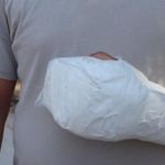 Sipariş almaya gittiği işletmede döner bıçaklı saldırıya uğradı, eline 30 dikiş atıldı