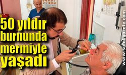 50 yıldır burnunda mermiyle yaşadı