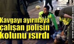 Kavgayı ayırmaya çalışan polisin kolunu ısırdı