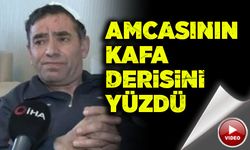 Amcasının kafa derisini yüzdü!