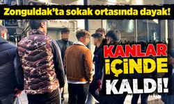 Zonguldak’ta sokak ortasında dayak! Kanlar içinde kaldı!