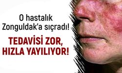 O hastalık Zonguldak’a sıçradı! Tedavisi zor, hızla yayılıyor!