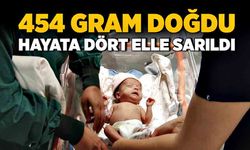 454 gram doğdu, hayata dört elle sarıldı!