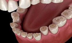 Uzmanlar son dönemde artan diş sıkma ve bruksizm sorunu için uyarıyor