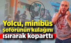 Yolcu, minibüs şoförünün kulağını ısırarak koparttı