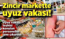 Zincir markette uyuz vakası! Personel izne ayrıldı