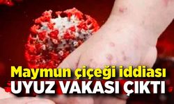 Maymun çiçeği iddiası uyuz vakası çıktı