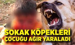 Başıboş köpeklerin saldırdığı çocuk ağır yaralandı