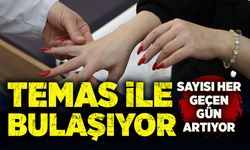 Temas ile bulaşıyor, sayısı her geçen gün artıyor