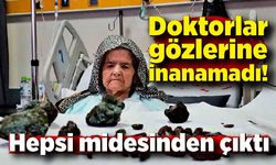 Görenler şok oldu: Hepsi midesinden çıktı