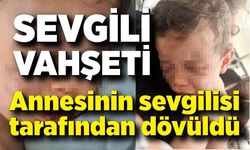 Vahşeti yaşayan 2 yaşındaki bebek hastanelik oldu; Annesinin erkek arkadaşı tarafından dövüldü