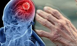 Why do people choose treatment of Parkinson’s disease abroad?