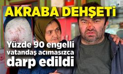 Yüzde 90 engelli vatandaş acımasızca darp edildi
