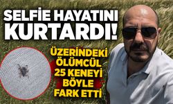 Selfie hayatını kurtardı! Üzerindeki ölümcül 25 keneyi böyle fark etti