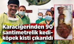 Hastanın karaciğerinden 90 santimetrelik kedi-köpek kisti çıkarıldı