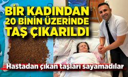 Hastadan çıkan taşları sayamadılar; Bir kadından 20 binin üzerinde taş çıkarıldı
