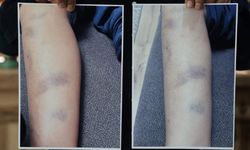 Özel okulda 8 yaşındaki çocuğun darbedildiği iddiası