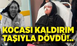 Kocası kaldırım taşıyla dövdü; Yüzü gözü kanlar içinde kalan kadın hastaneye kaldırıldı
