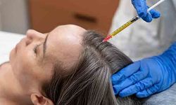 İlk Saç Ekimi Her Zaman İstenen Sonucu Verir Mi?