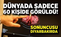 Dünyada Sadece 60 Kişide Görüldü! Penis kaybına neden oldu