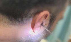 Kulağının içine uyuşturucu saklayan şüpheli yakalandı