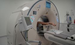 Türkiye'de 4 merkezde var: Sanal anjiyografi yapabilen yapay zekalı tomografi Samsun'da