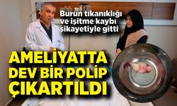 Burun tıkanıklığı ve işitme kaybı şikayetiyle gitti, ameliyatta dev bir polip çıkartıldı