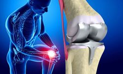 Diz ağrısını hafife almayın: Sinsi tehlike menisküs kök yırtıkları