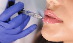 Dudak Dolgusu Fiyatları 2026: Neye Göre Değişir, Ortalama Ücretler Nedir?