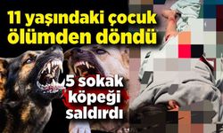 5 sokak köpeğinin saldırdığı çocuk ölümden döndü