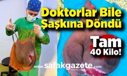 Doktorlar Bile Şaşkına Döndü: Tam 40 Kilo!