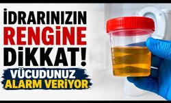İdrarınızın Rengine Dikkat! Vücudunuz Alarm Veriyor