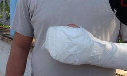 Sipariş almaya gittiği işletmede döner bıçaklı saldırıya uğradı, eline 30 dikiş atıldı