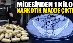 Midesinden 1 kilo narkotik madde çıktı