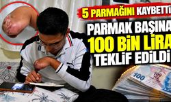 5 parmağını kaybetti, parmak başına 100 bin lira teklif edildi