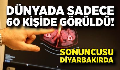 Dünyada Sadece 60 Kişide Görüldü! Penis kaybına neden oldu