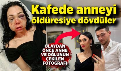 Oğlunun gözü önünde anneyi öldüresiye dövdüler: "'Küfür etmeyin' dedik diye bu hale geldim"