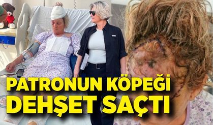 Patronun köpeği dehşet saçtı: Vücuduna 80 dikiş atılan kadın koruma ölümden döndü