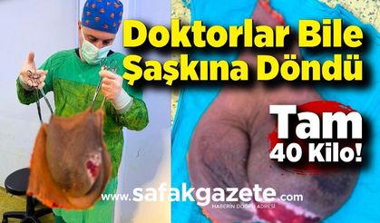 Doktorlar Bile Şaşkına Döndü: Tam 40 Kilo!