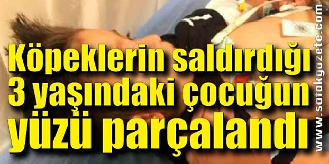 Köpeklerin saldırdığı 3 yaşındaki çocuğun yüzü parçalandı