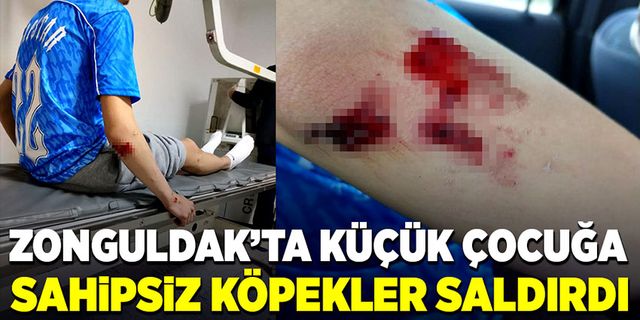 Küçük çocuğa Zonguldak'ta sahipsiz köpekler saldırdı