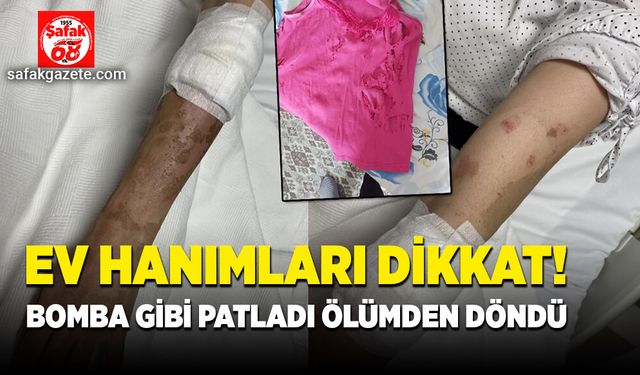 Ev hanımları dikkat! Bomba gibi patladı ölümden döndü