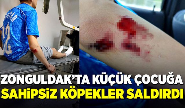 Küçük çocuğa Zonguldak'ta sahipsiz köpekler saldırdı