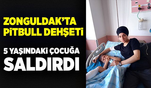 Zonguldak’ta pitbull dehşeti: 5 yaşındaki çocuğa saldırdı!