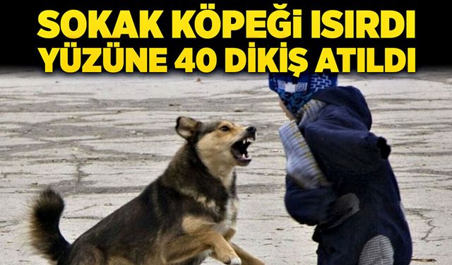 6 yaşındaki çocuğu sokak köpeği ısırdı, yüzüne 40 dikiş atıldı