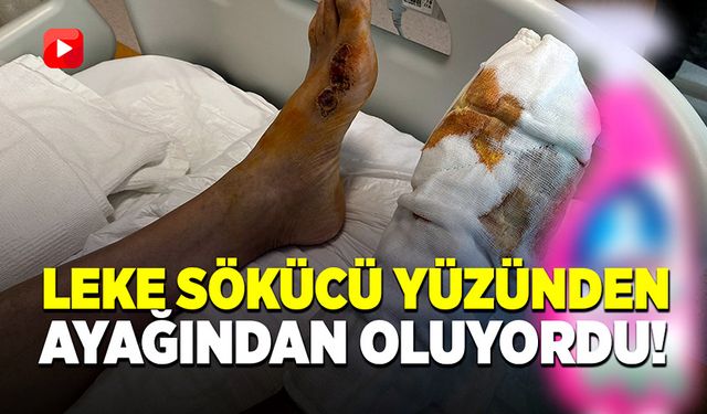 Leke sökücü temizlik ürünü yüzünden ayağından oluyordu!