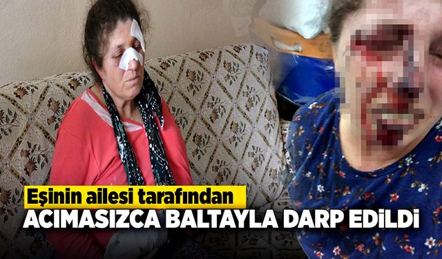 Korkunç olay, eşinin ağabeyi ve yeğeni kadını acımasızca darp etti!