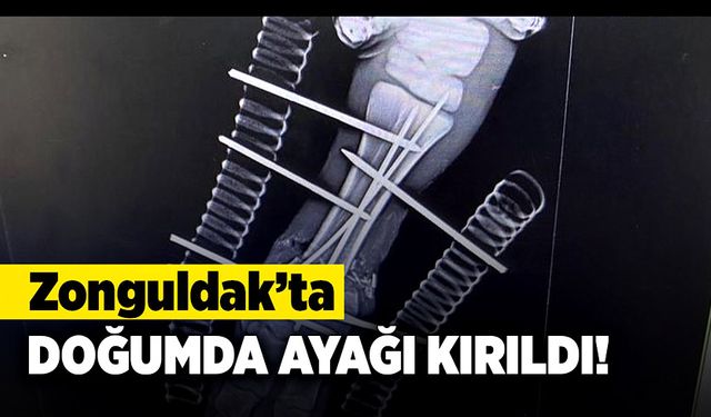 Çaycuma’da doğum sırasında ayağı kırıldı!